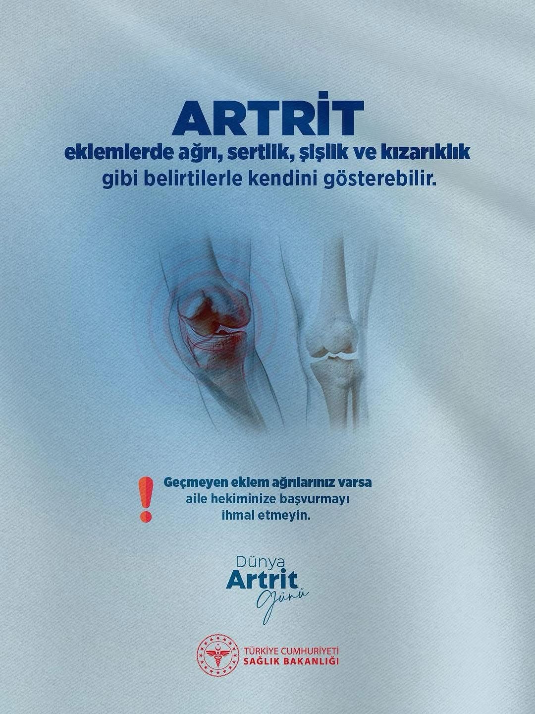 Artrit Hastalığı ve Belirtileri Hakkında Bilinmesi Gerekenler